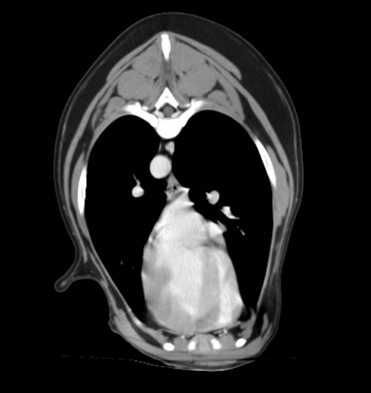 CT imaging at Summit