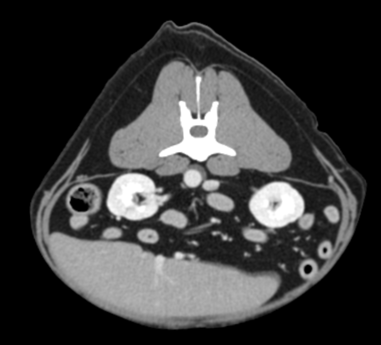 CT scan results