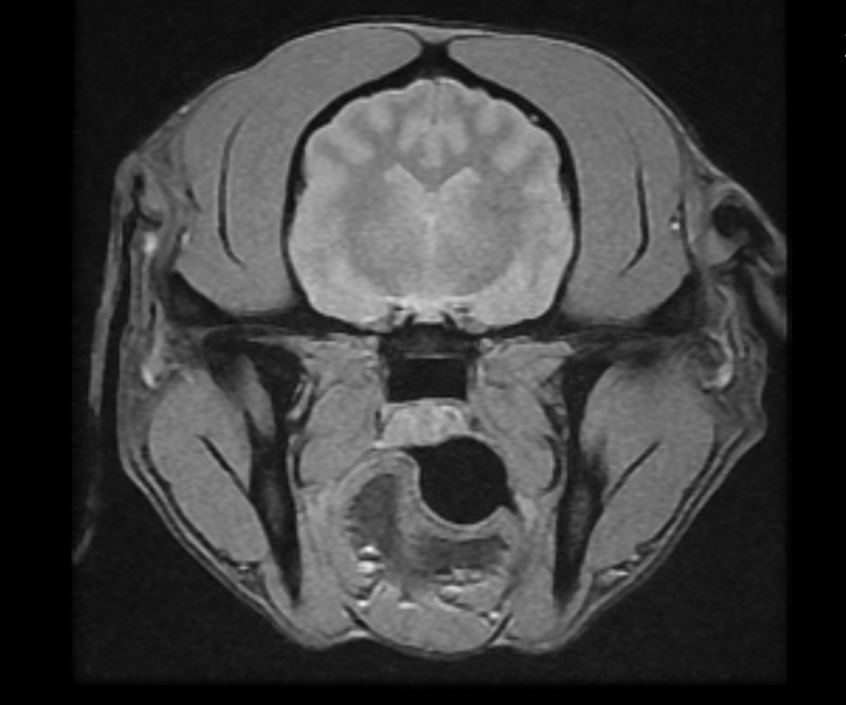 MRI imaging at Summit